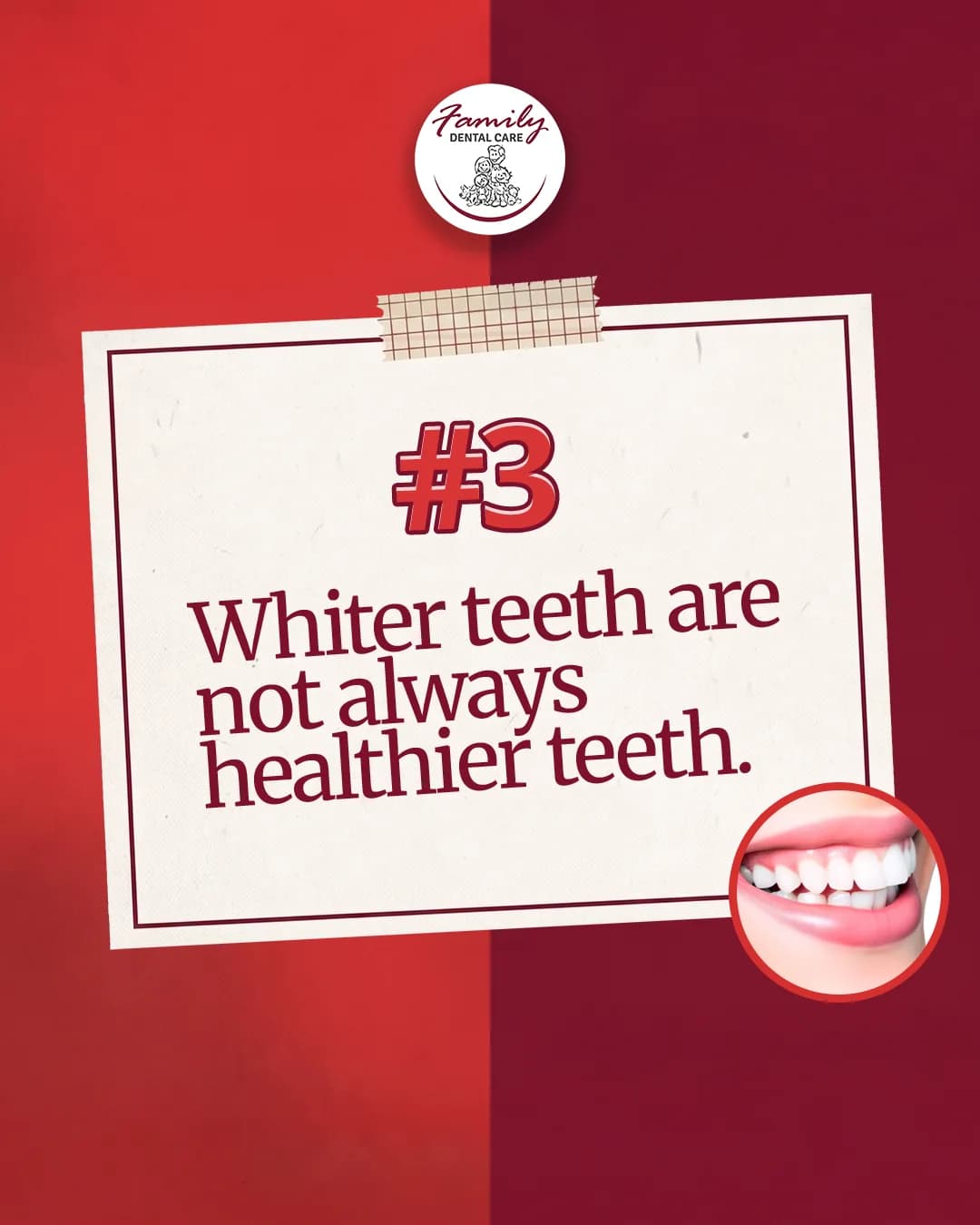 Family Dental Care carousel slide: whiter teeth are not always healthier teeth
